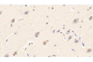 Detection of SIGLEC14 in Human Cerebrum Tissue using Polyclonal Antibody to Sialic Acid Binding Ig Like Lectin 14 (SIGLEC14) (SIGLEC14 antibody  (AA 24-137))