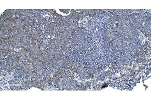 IHC analysis of DRP1/DNM1L using anti-DRP1/DNM1L antibody (ABIN7602180).