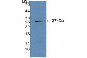 Detection of Recombinant CLEC10A, Mouse using Polyclonal Antibody to Cluster Of differentiation 301 (CD301)