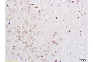 Formalin-fixed and rat brain tissue labeled with Anti-Midnolin Polyclonal Antibody, Unconjugated  1:200 followed by conjugation to the secondary antibody and DAB staining