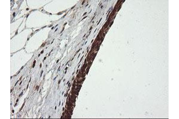 OTUB1 antibody