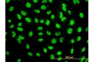 Image no. 2 for anti-serine/threonine Kinase 38 (STK38) (AA 1-466) antibody (ABIN599179) (STK38 antibody  (AA 1-466))
