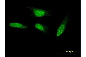 Immunofluorescence of monoclonal antibody to SEC14L2 on HeLa cell. (SEC14L2 antibody  (AA 101-199))