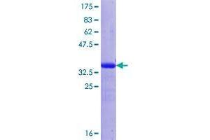 FSTL1 Protein (AA 209-306) (GST tag)