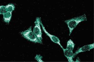 Immunofluorescence staining of HeLa cells (Human cervical epitheloid carcinoma, ATCC CCL-2. (ITGB1 antibody  (AA 76-256))
