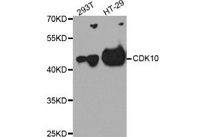 Western blot analysis of extracts of various cell lines, using CDK10 antibody. (CDK10 antibody)