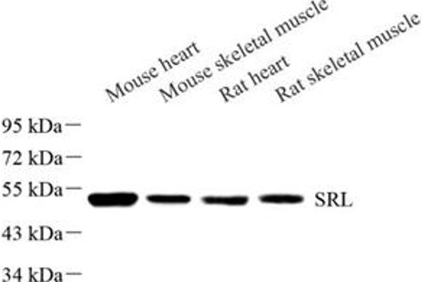 Sarcalumenin antibody