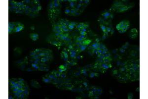 Immunofluorescent staining of HepG2 cells using anti-ALDH2 mouse monoclonal antibody (ABIN2452752). (ALDH2 antibody)