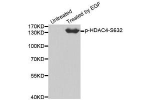 Western blot analysis of extracts from 293 cells using Phospho-HDAC4-S632 antibody (ABIN2988040). (HDAC4 antibody  (pSer632))