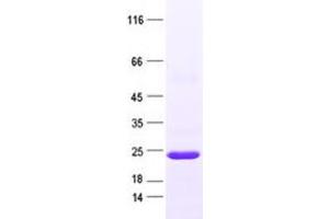 Validation with Western Blot (ARPC4 Protein (His tag))