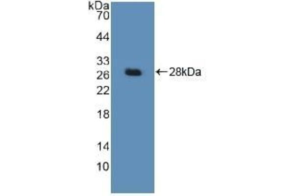 DDB2 antibody  (AA 166-383)