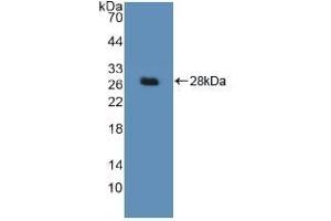 Detection of Recombinant DDB2, Human using Polyclonal Antibody to Damage Specific DNA Binding Protein 2 (DDB2) (DDB2 antibody  (AA 166-383))