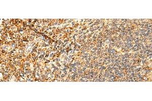 Immunohistochemistry of paraffin-embedded Human tonsil tissue using PPM1B Polyclonal Antibody at dilution of 1:50(x200) (PPM1B antibody)