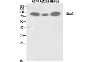 Western Blotting (WB) image for anti-Signal Transducer and Activator of Transcription 3 (Acute-Phase Response Factor) (STAT3) (Tyr705) antibody (ABIN5961851) (STAT3 antibody  (Tyr705))