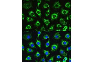 Immunofluorescence (IF) image for anti-ATG16 Autophagy Related 16-Like 1 (ATG16L1) (AA 200-300) antibody (ABIN6137248)