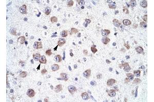 RALY antibody was used for immunohistochemistry at a concentration of 4-8 ug/ml to stain Neural cells (arrows) in Human Brain. (Raly antibody  (N-Term))