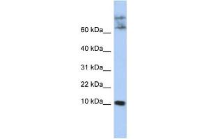 WB Suggested Anti-CKLF Antibody Titration:  0.