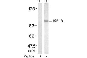 Image no. 2 for anti-Insulin-Like Growth Factor 1 Receptor (IGF1R) (Tyr1346) antibody (ABIN319345) (IGF1R antibody  (Tyr1346))