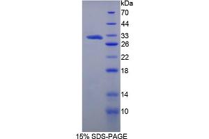 Image no. 1 for Methyltransferase Like 21C (METTL21C) (AA 1-248) protein (His tag) (ABIN4991132)