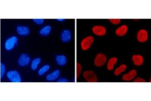 Immunofluorescence analysis of 293T cells using MonoMethyl-Histone H3-K9 Polyclonal Antibody (Histone 3 antibody  (meLys9))