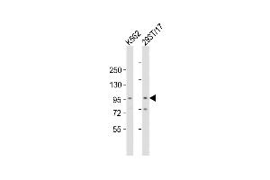 All lanes : Anti-Rai17 Antibody  at 1:2000 dilution Lane 1: K562 whole cell lysates Lane 2: 293T/17 whole cell lysates Lysates/proteins at 20 μg per lane. (ZMIZ1 antibody  (C-Term))
