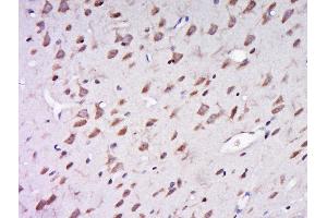 Paraformaldehyde-fixed, paraffin embedded rat brain, Antigen retrieval by boiling in sodium citrate buffer (pH6) for 15min, Block endogenous peroxidase by 3% hydrogen peroxide for 30 minutes, Blocking buffer (normal goat serum) at 37°C for 20min, Antibody incubation with Rabbit Anti-AER61 Polyclonal Antibody, Unconjugated  at 1:500 overnight at 4°C, followed by a conjugated secondary for 90 minutes and DAB staining (AER61 antibody)