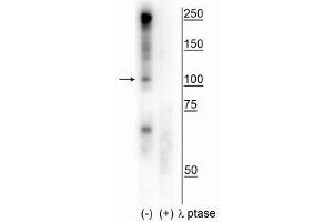Western blot of human T47D cell lysate showing specific immunolabeling of the ~100 kDa CtIP phosphorylated at Ser327 in the first lane (-). (Retinoblastoma Binding Protein 8 antibody  (pSer327))