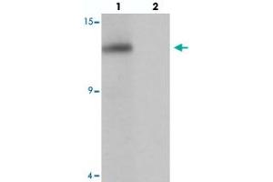 Western blot analysis of SDHAF2 in rat liver tissue with SDHAF2 polyclonal antibody  at 1 ug/mL in (lane 1) the absence and (lane 2) the presence of blocking peptide.