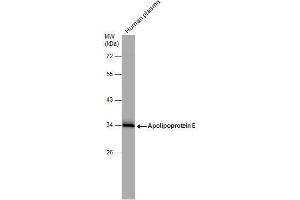 WB Image Human tissue extract (30 μg) was separated by 10% SDS-PAGE, and the membrane was blotted with Apolipoprotein E antibody , diluted at 1:1000. (APOE antibody  (N-Term))