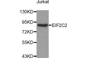 Western blot analysis of extracts of Jurkat cell lines, using AGO2 antibody. (AGO2 antibody)