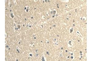 Detection of CALML3 in Human Cerebrum Tissue using Polyclonal Antibody to Calmodulin Like Protein 3 (CALML3) (CALML3 antibody  (AA 1-149))