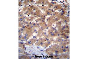 UBE2NL Antibody (N-term) immunohistochemistry analysis in formalin fixed and paraffin embedded human liver tissue followed by peroxidase conjugation of the secondary antibody and DAB staining. (UBE2NL antibody  (N-Term))