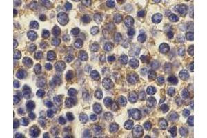 Immunohistochemistry (Paraffin-embedded Sections) (IHC (p)) image for anti-Tumor Necrosis Factor Receptor Superfamily, Member 17 (TNFRSF17) antibody (ABIN499437)