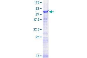 SEMA3D Protein (AA 1-416) (GST tag)