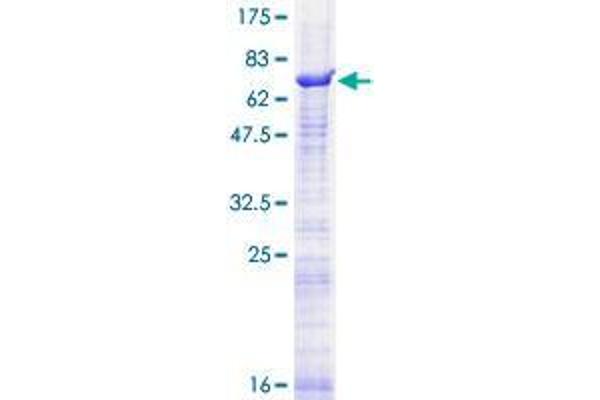SEMA3D Protein (AA 1-416) (GST tag)