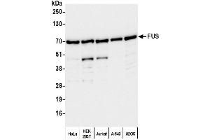 Western Blotting (WB) image for anti-Fused in Sarcoma (FUS) (AA 400-450) antibody (ABIN7453433) (FUS antibody  (AA 400-450))