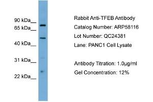 WB Suggested Anti-TFEB  Antibody Titration: 0. (TFEB antibody  (Middle Region))