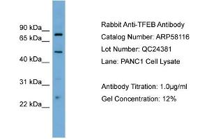 WB Suggested Anti-TFEB  Antibody Titration: 0.