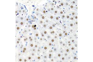 Immunohistochemistry of paraffin-embedded rat liver using PTBP1 antibody at dilution of 1:100 (40x lens). (PTBP1 antibody)