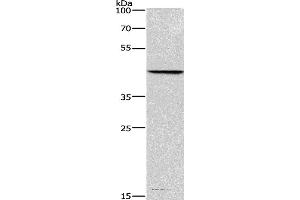 Western blot analysis of Hela cell, using BGN Polyclonal Antibody at dilution of 1:550 (Biglycan antibody)