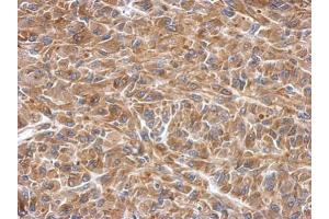 IHC-P Image Immunohistochemical analysis of paraffin-embedded U87 xenograft, using SLK, antibody at 1:500 dilution. (SLK antibody)