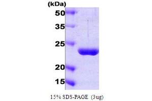 SDS-PAGE (SDS) image for Proteasome (Prosome, Macropain) 26S Subunit, Non-ATPase, 10 (PSMD10) (AA 1-226) protein (ABIN667086) (PSMD10 Protein (AA 1-226))