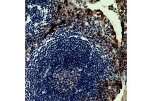 Immunohistochemical analysis of CD62P staining in human tonsil formalin fixed paraffin embedded tissue section.