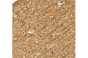 anti-2',3'-Cyclic Nucleotide 3' phosphodiesterase (CNP) (AA 1-421) antibody