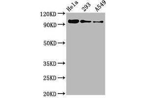 Western Blot Positive WB detected in Hela whole cell lysate ? (Recombinant FOXO3 antibody  (pSer253))
