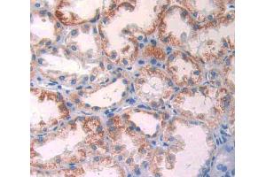 Immunohistochemistry (IHC) image for anti-Glutamate Dehydrogenase 1 (GLUD1) (AA 334-556) antibody (ABIN1858993)