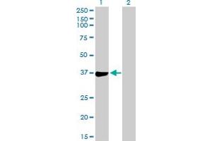 Western Blot analysis of PHF11 expression in transfected 293T cell line by PHF11 MaxPab polyclonal antibody. (PHF11 antibody  (AA 1-292))