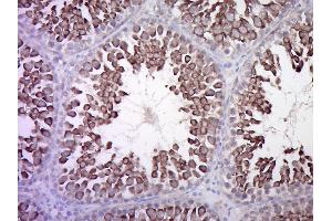 Paraformaldehyde-fixed, paraffin embedded Rat Testis Antigen retrieval by boiling in sodium citrate buffer (pH6. (Calcitonin Receptor antibody  (AA 31-120))