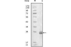 Western blot analysis using FBLN5 mouse mAb against truncated FBLN5-His recombinant protein. (Fibulin 5 antibody  (AA 242-448))