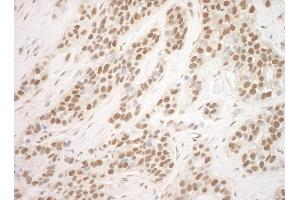 anti-Pogo Transposable Element with ZNF Domain (POGZ) (AA 1360-1410) antibody
